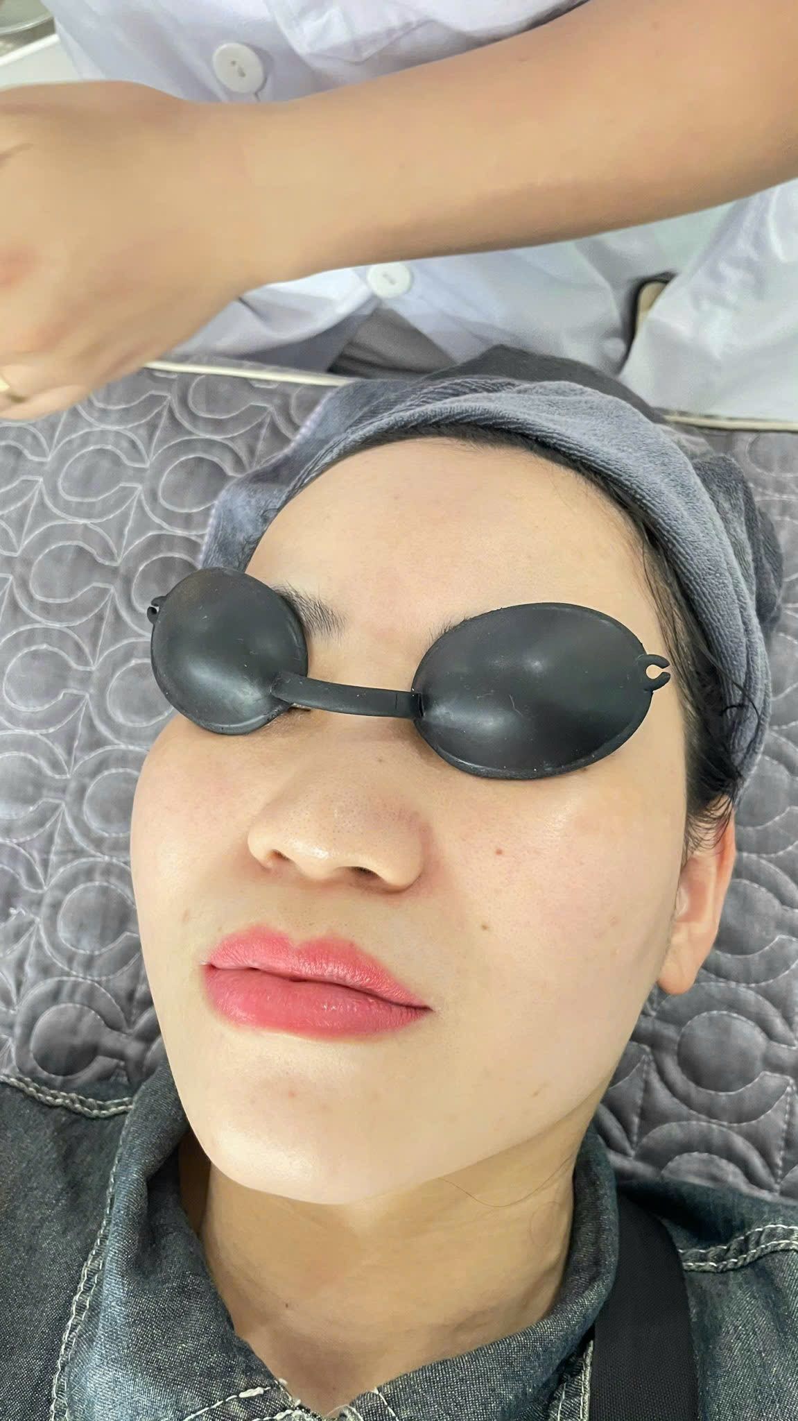 Trẻ hóa da công nghệ cao
